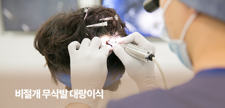 비절개 무삭발 대랑이식