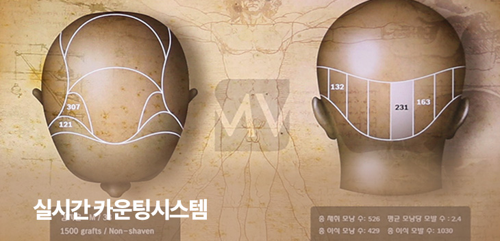 실시간 카운팅시스템