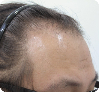 수술 전 상태