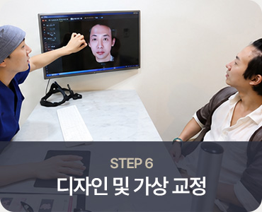 모발이식 STEP 6 디자인 및 가상 교정