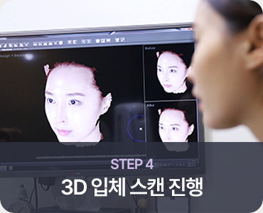 모발이식 STEP 4 3D 입체 스캔 진행