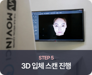 모발이식 STEP 5 3D 입체 스캔 진행