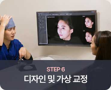 모발이식 STEP 6 디자인 및 가상 교정