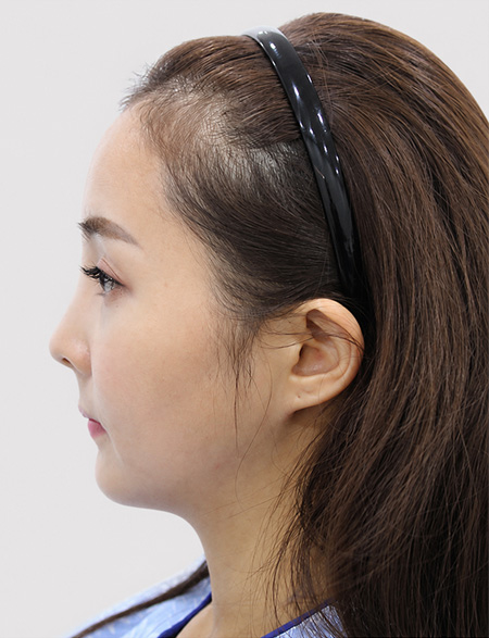 수술 전 상태