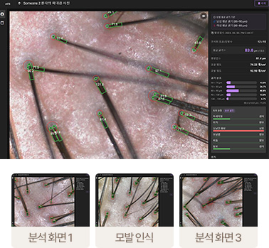AI 분석 화면