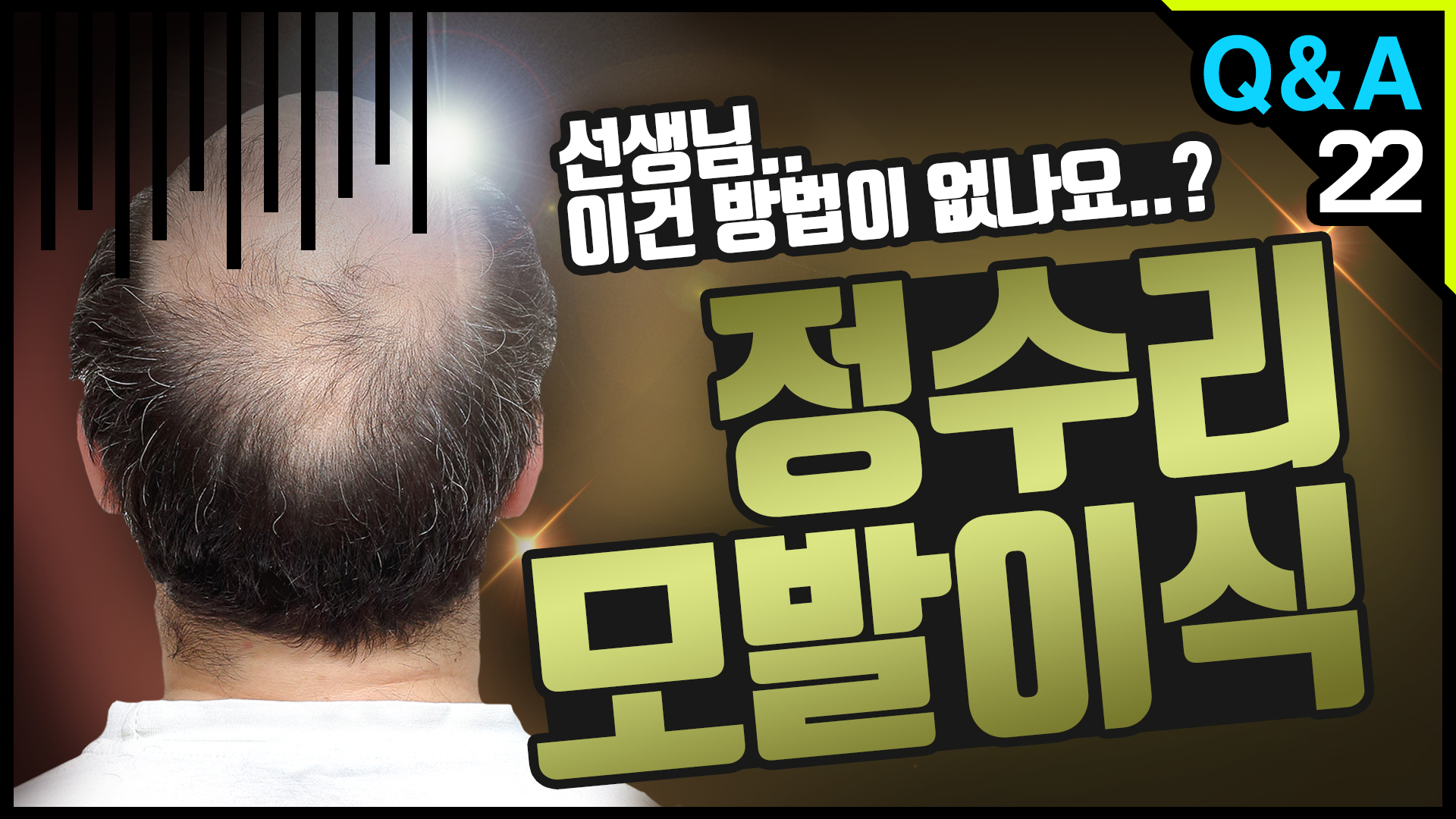 영상 썸네일
