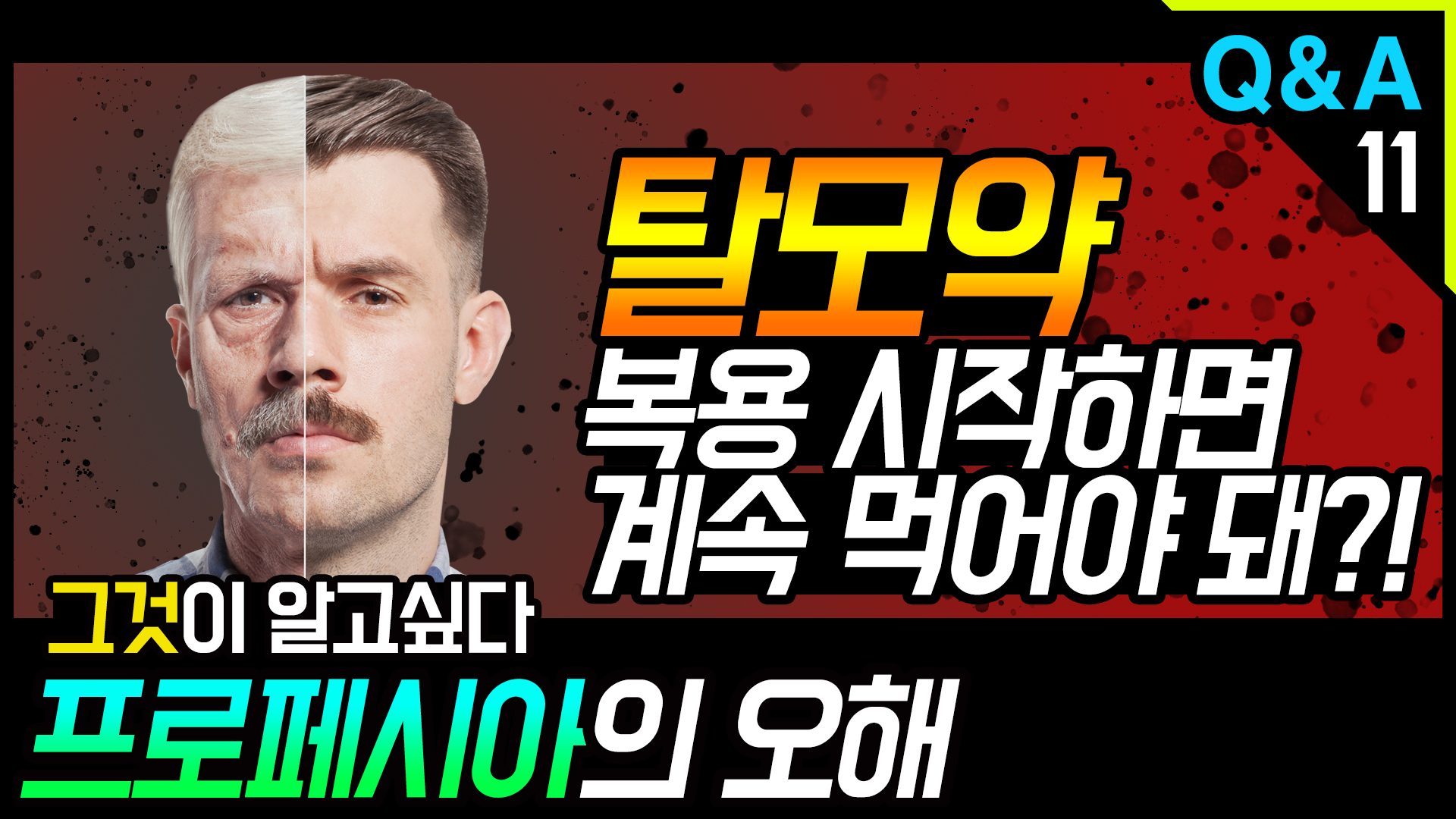 영상 썸네일